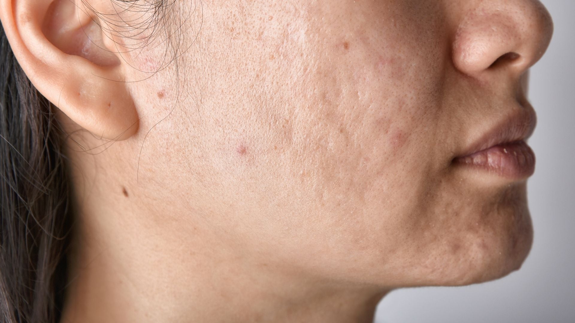 AR & UJÆVN HUDSTRUKTUR - Sara Lorentsen Skin Expert