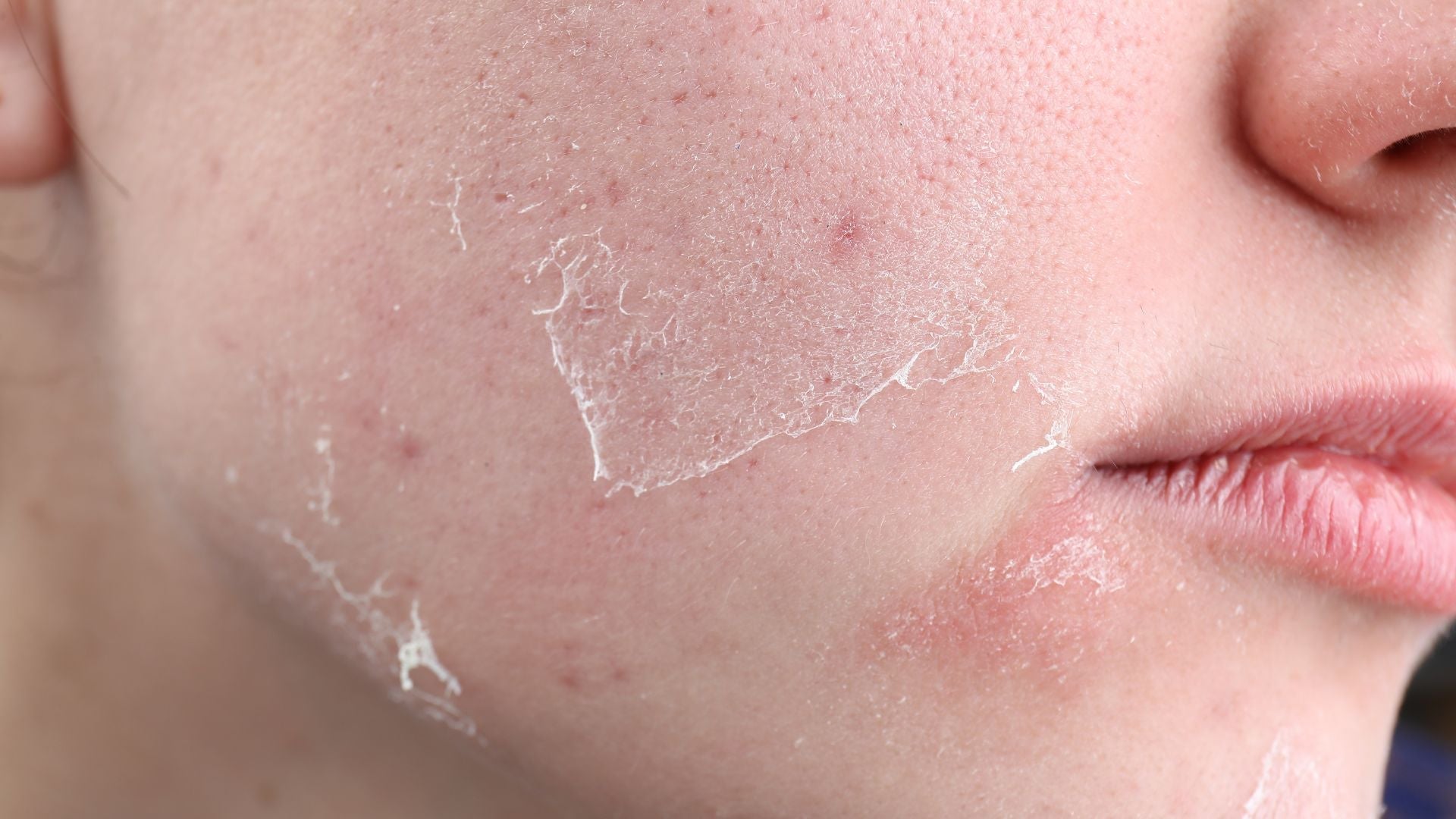 TØR HUD - Sara Lorentsen Skin Expert