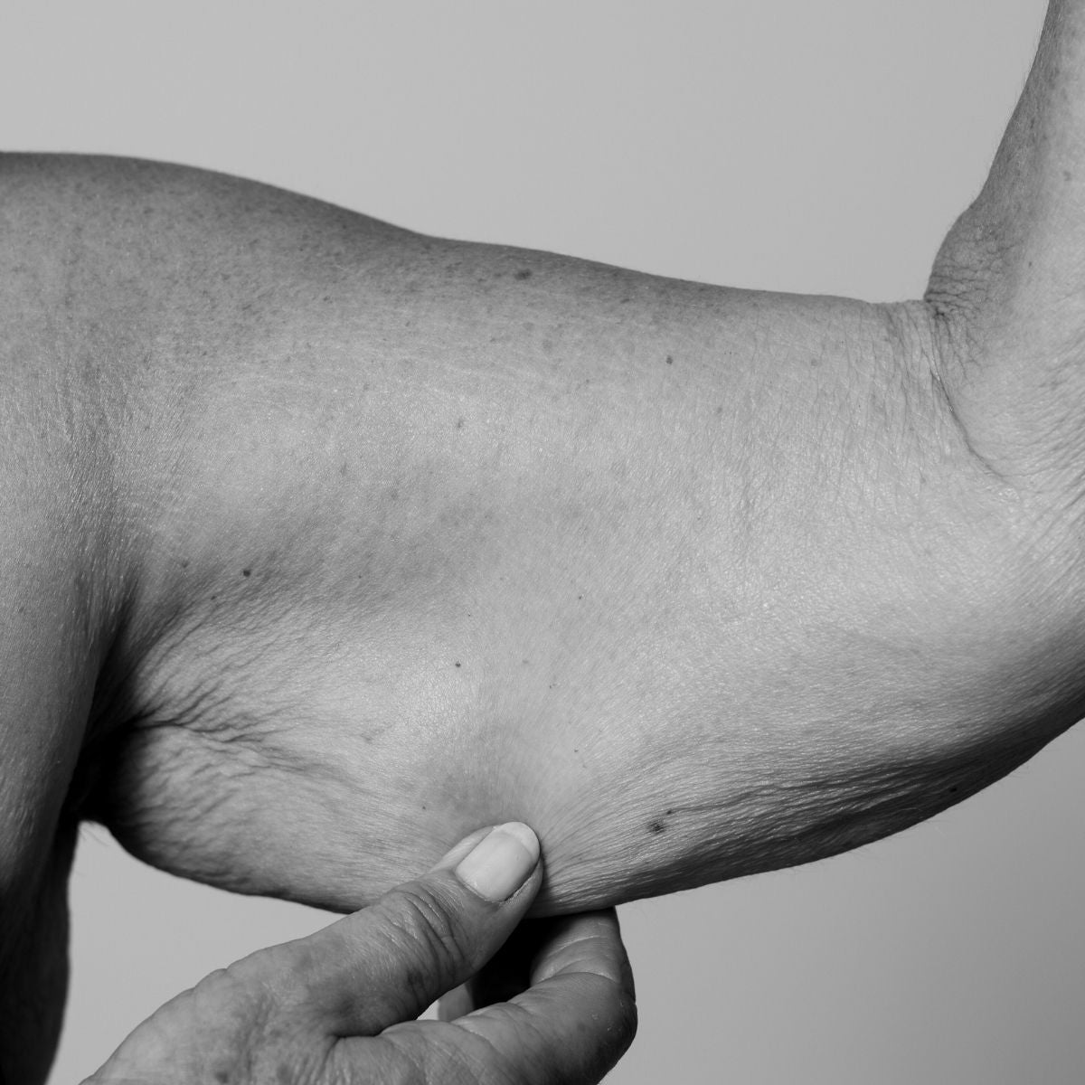 Cellulite & Firming-behandling af hænder og overarme hos Obsido Studio i Vejle