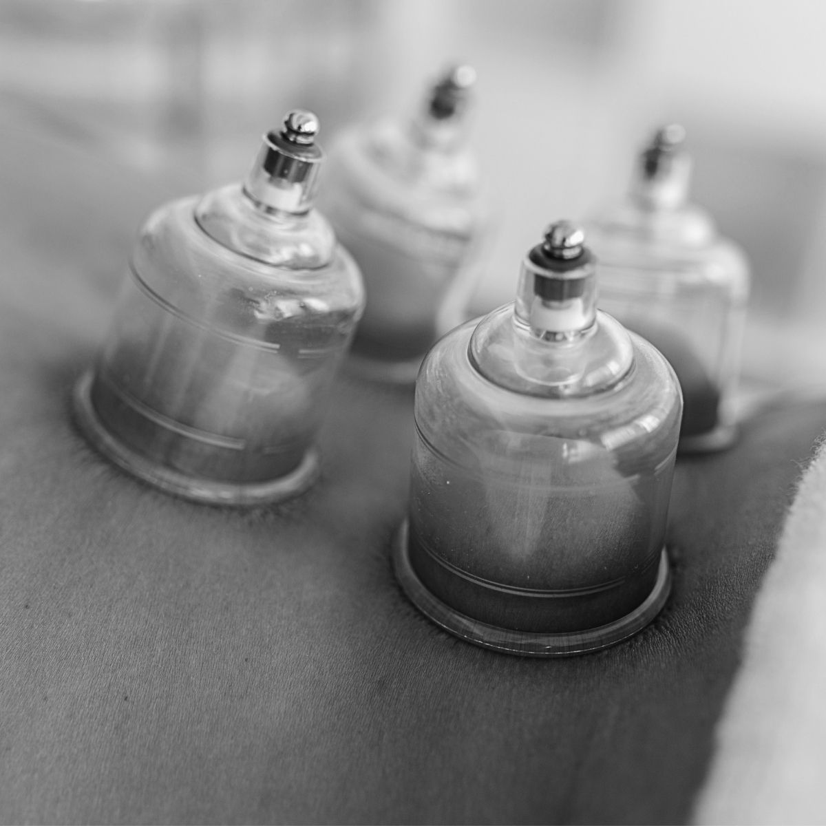 Cupping og zonetryk - Behandler: Julie - Obsido Skin Studio by Sara Lorentsen